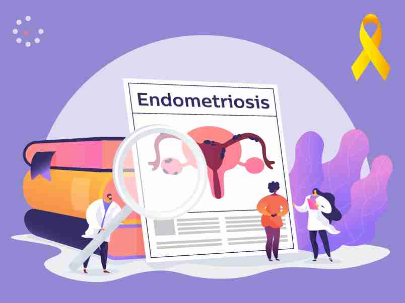 5 cosas que deberías saber sobre la endometriosis