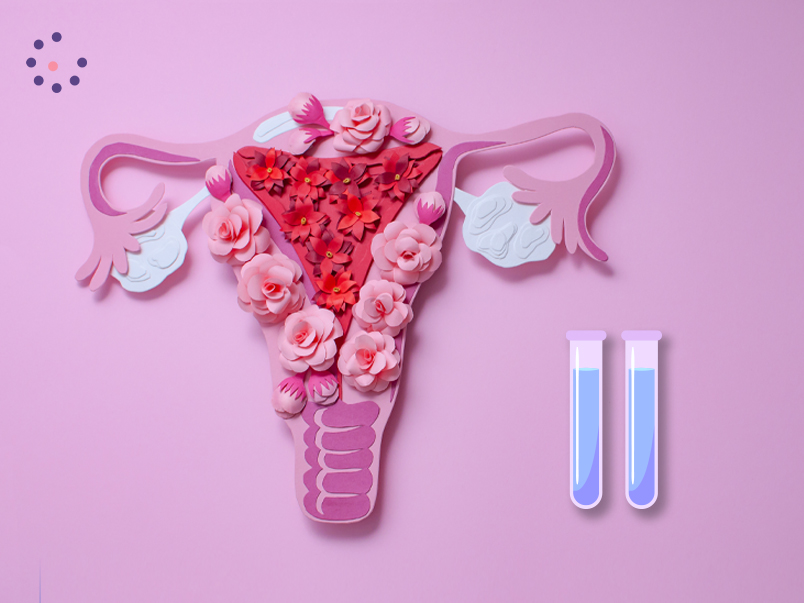 Terapia endometrial con plasma rico en plaquetas (PRP), ¿es beneficioso para mi caso?