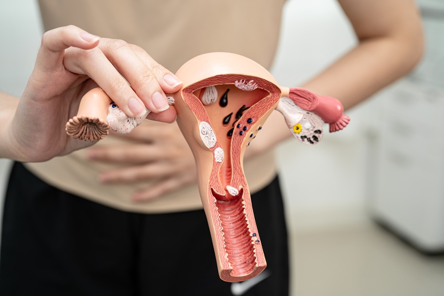 I have ovarian cancer, can I still become a mother?